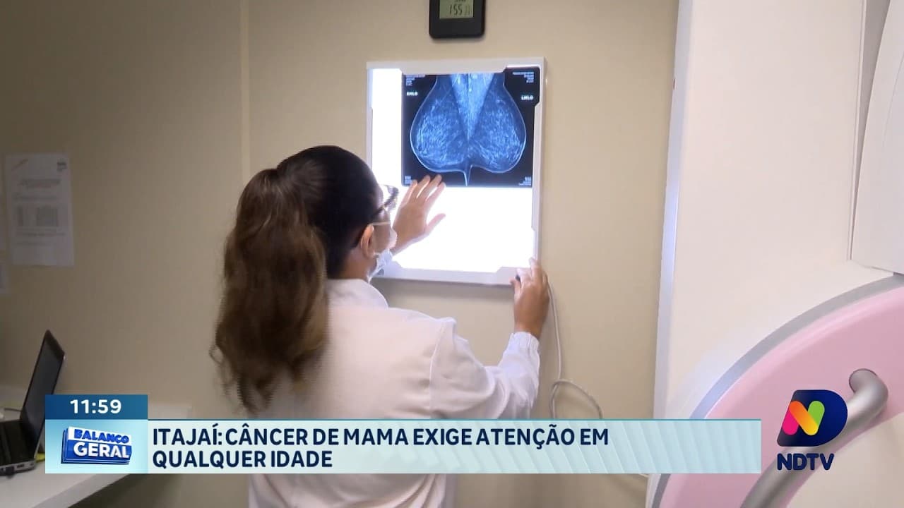 Câncer de mama exige atenção em mulheres de todas as idades em Itajaí