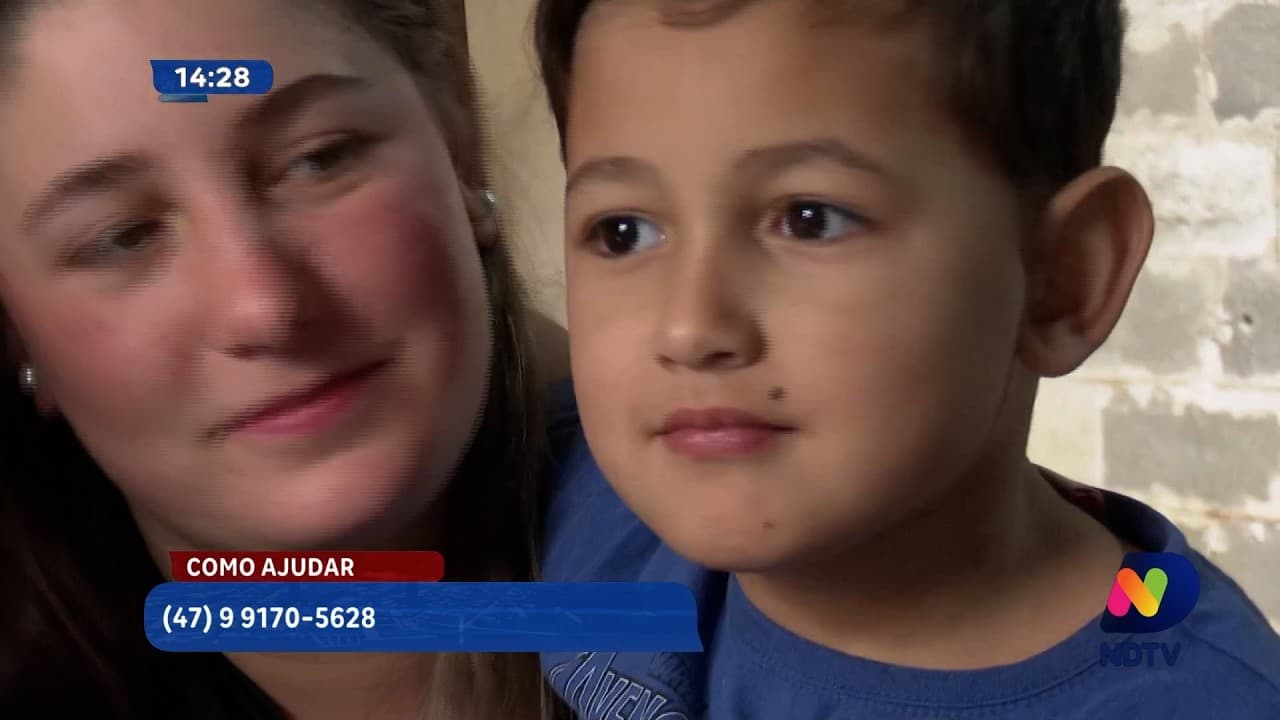 Dois Anos de Espera: Jovem Relata Drama por Cirurgia no SUS em Itajaí